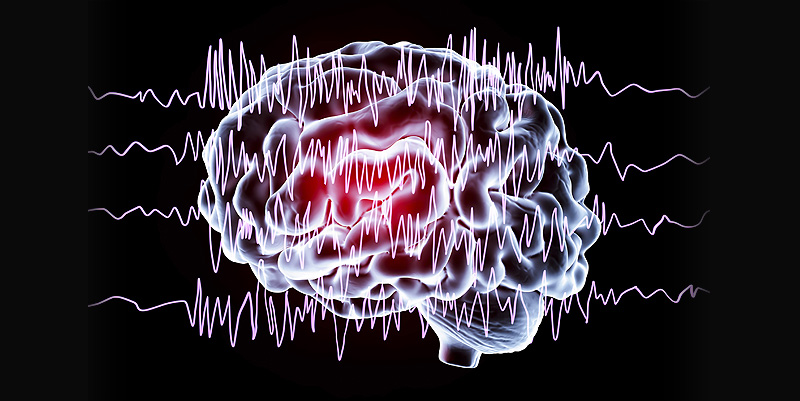 illustration de Epilepsie et conduite