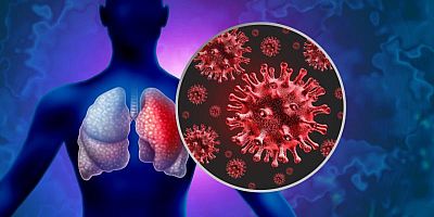 Le virus syncytial respiratoire peut nécessiter un séjour en réanimation.